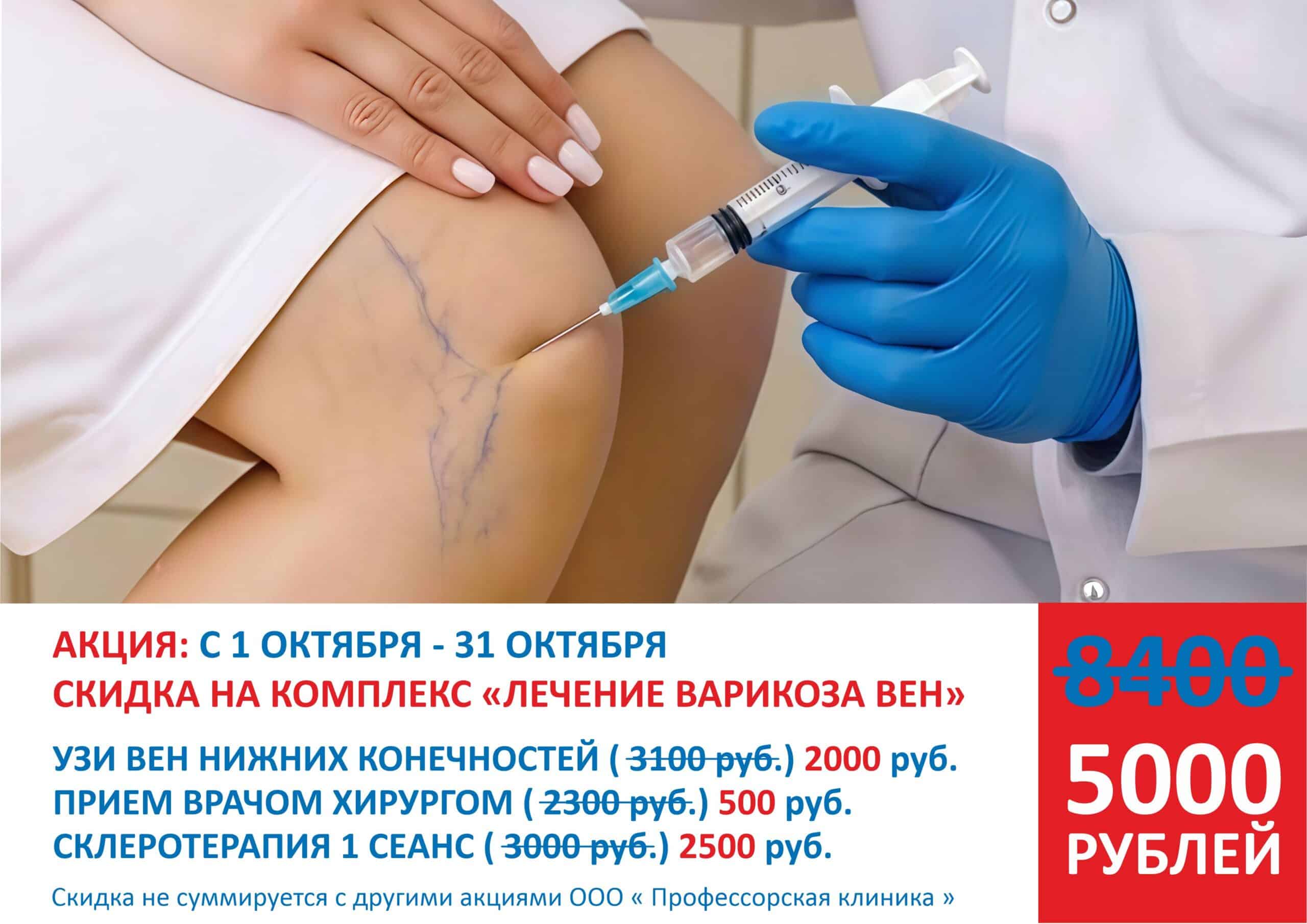 акция лечение варикоза вен
