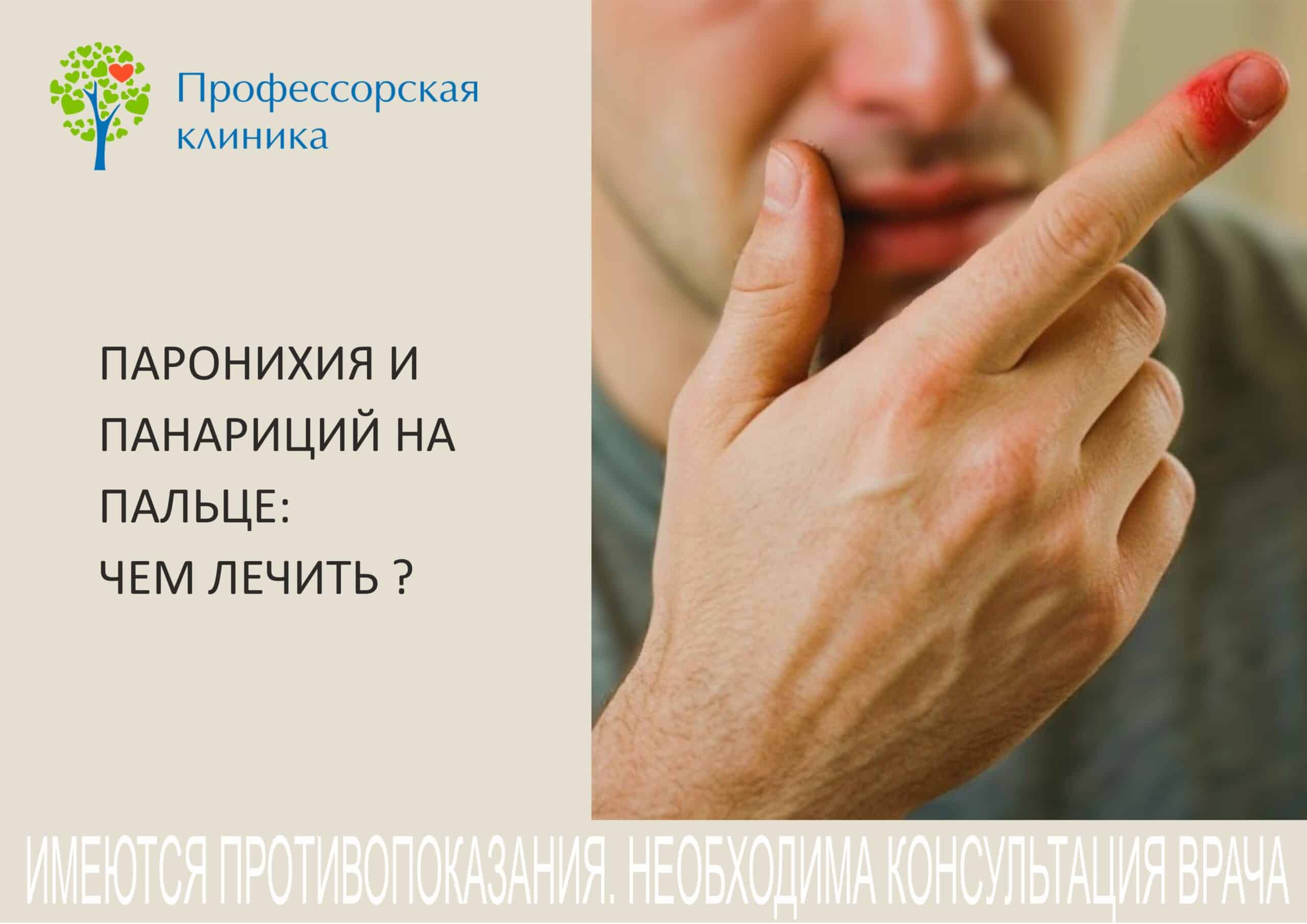 Паронихия и панариций на пальце чем лечить
